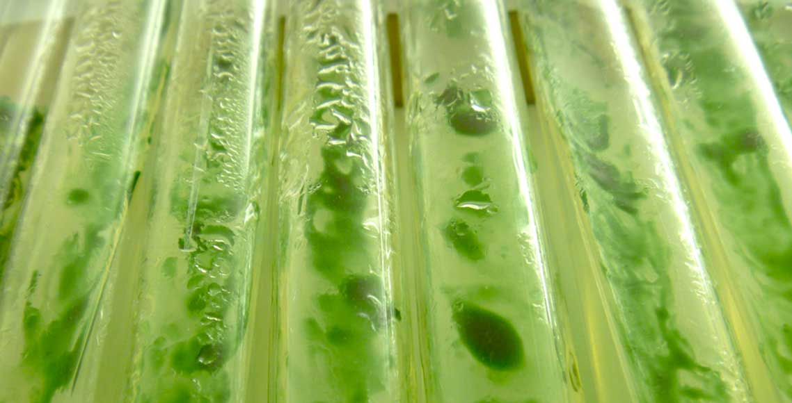 A casa da microalga: migração forçada